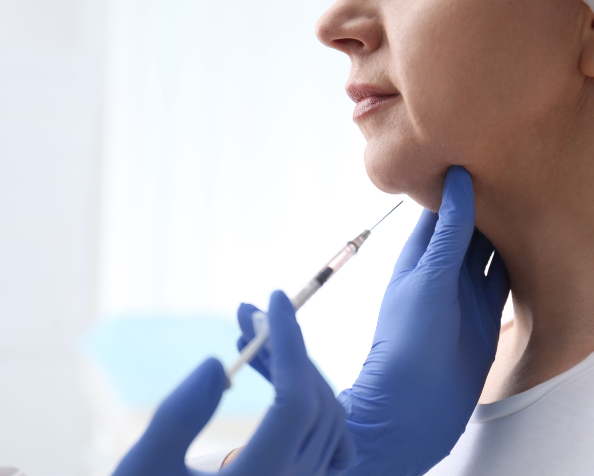 Treatment that is used to reduce the appearance of Double Chin