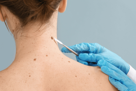 Skin Cancer Clinic